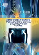 Эндопротезирование тазобедренного сустава в нестандартных случаях. Волошенюк, А. Н.